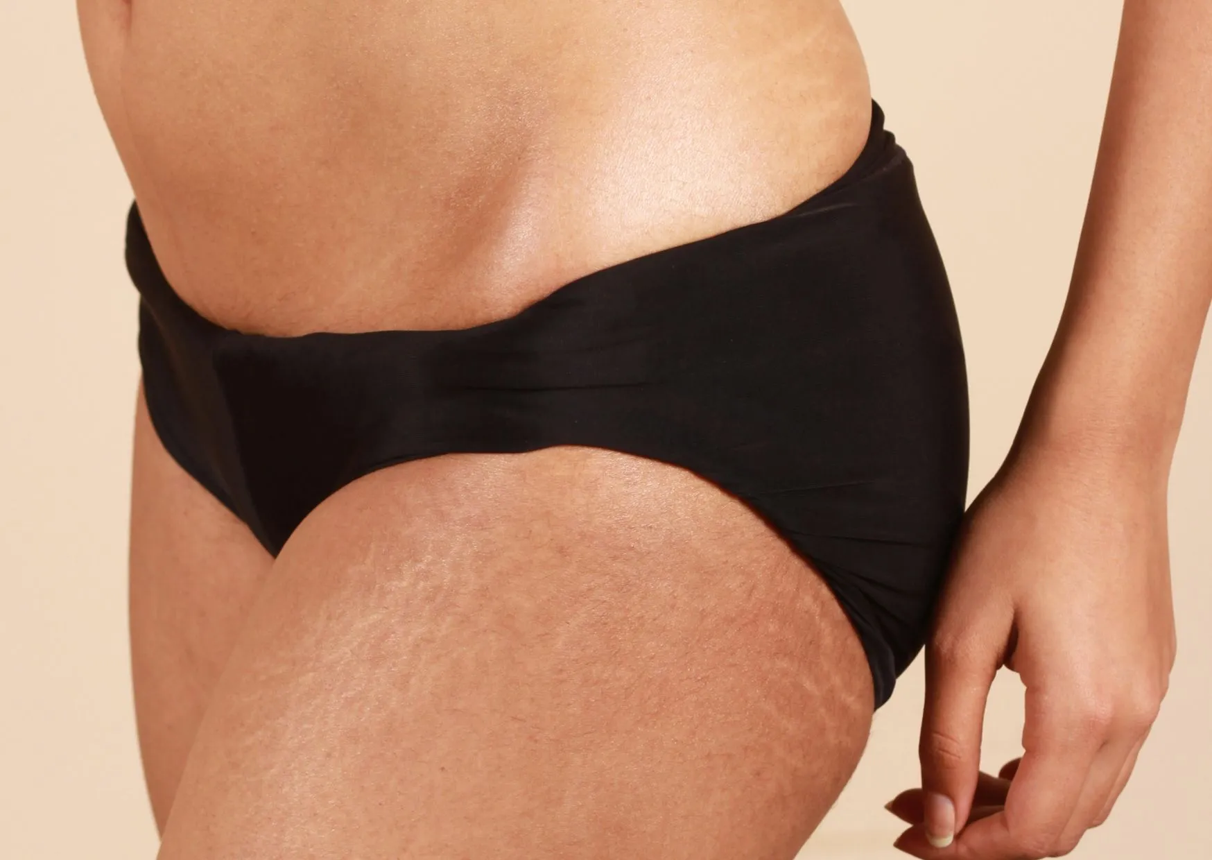 Liposuctie benen kosten