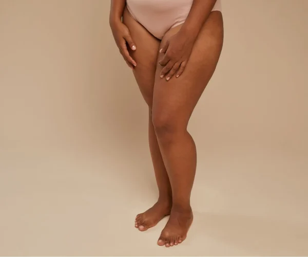 Liposuctie benen