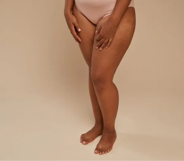 Liposuctie benen