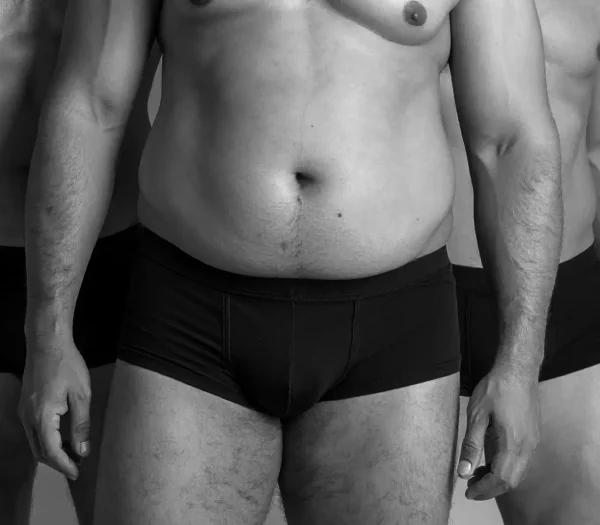 Liposuctie behandeling buik mannen buikvet man