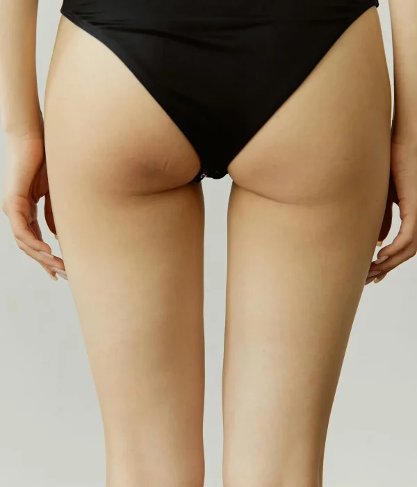Lipofilling Billen Tumescent Techniek