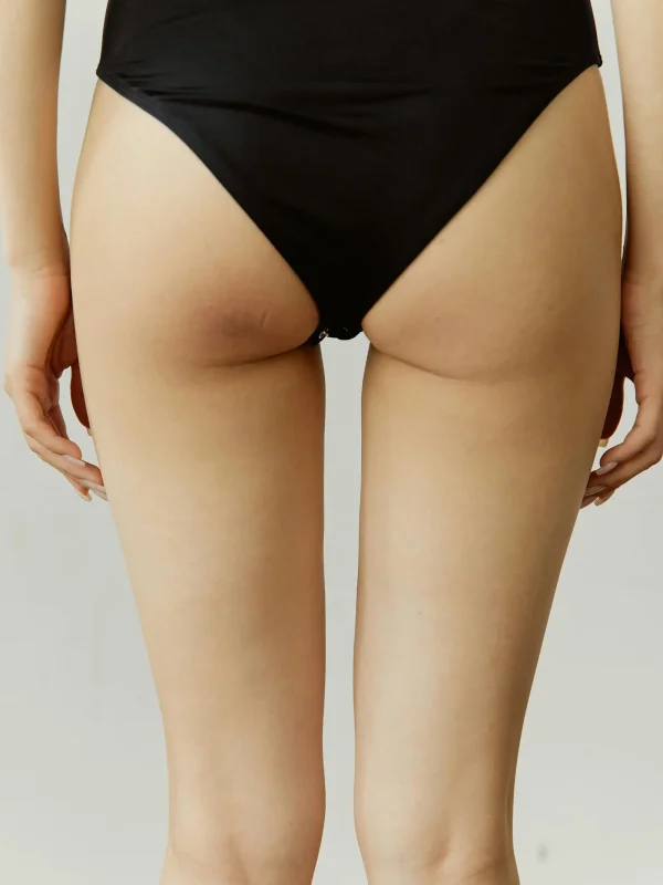 Lipofilling Billen Tumescent Techniek