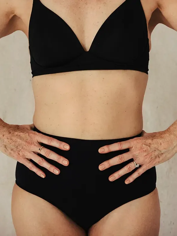Lipofilling