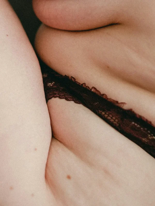 Liposuctie flanken met Tumescent Techniek