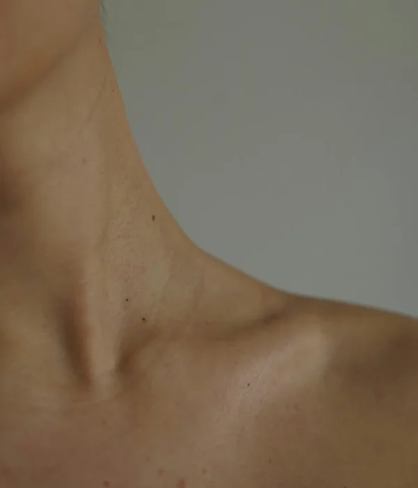 Liposuctie hals met Tumescent Techniek