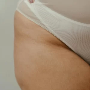 Liposuctie lovehandles met Tumescent Techniek