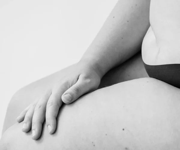 Liposuctie zadeltassen met Tumescent Techniek