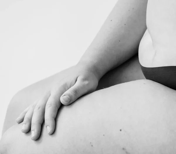 Liposuctie zadeltassen met Tumescent Techniek