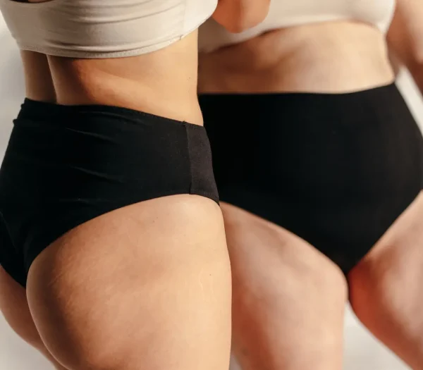 Liposuctie benen