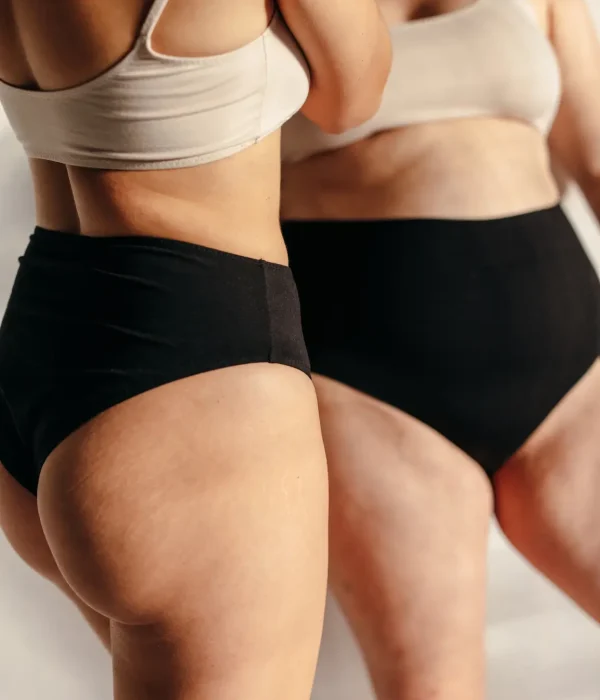 Liposuctie benen