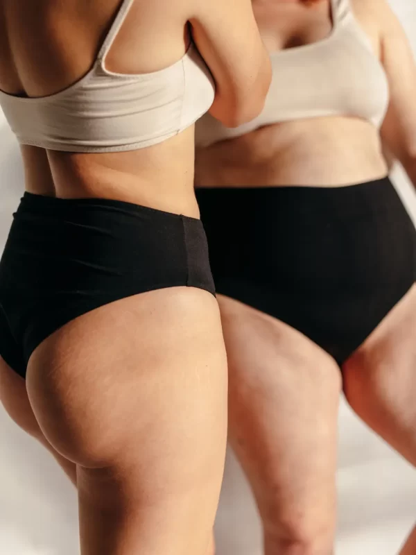 Liposuctie benen