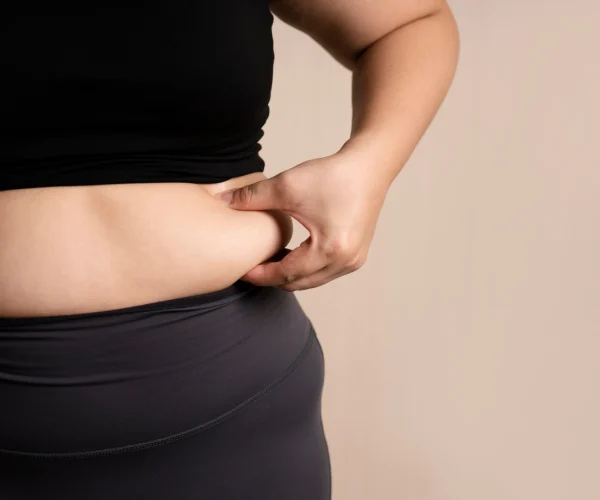 Liposuctie van de buik