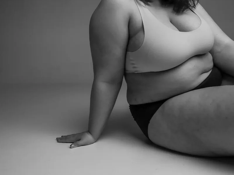 Shaping your body liposuctie lipoedeem lipofilling