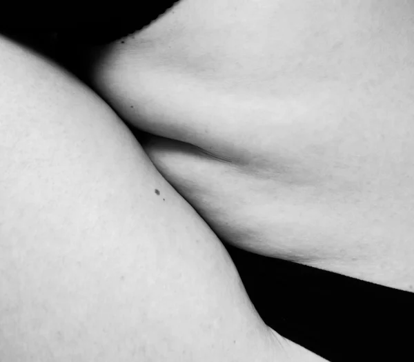 Tumescente liposuctie onder plaatselijke verdoving
