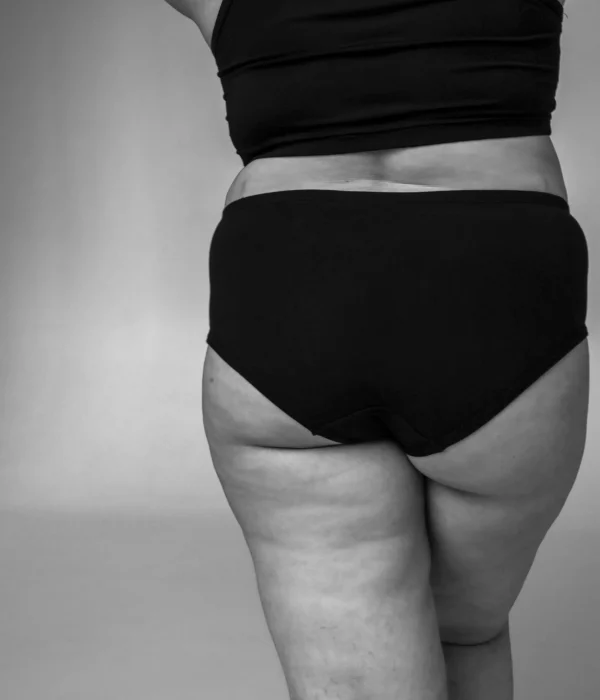 Dikke benen: oorzaken & behandeling