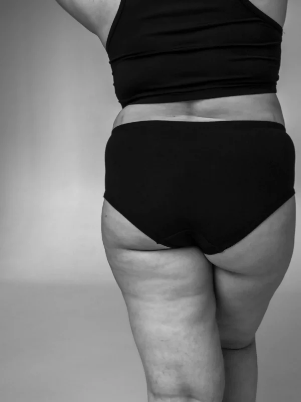 Dikke benen: oorzaken & behandeling