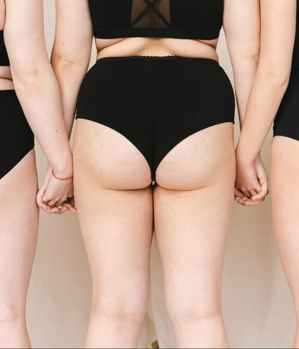 Lipofilling billen